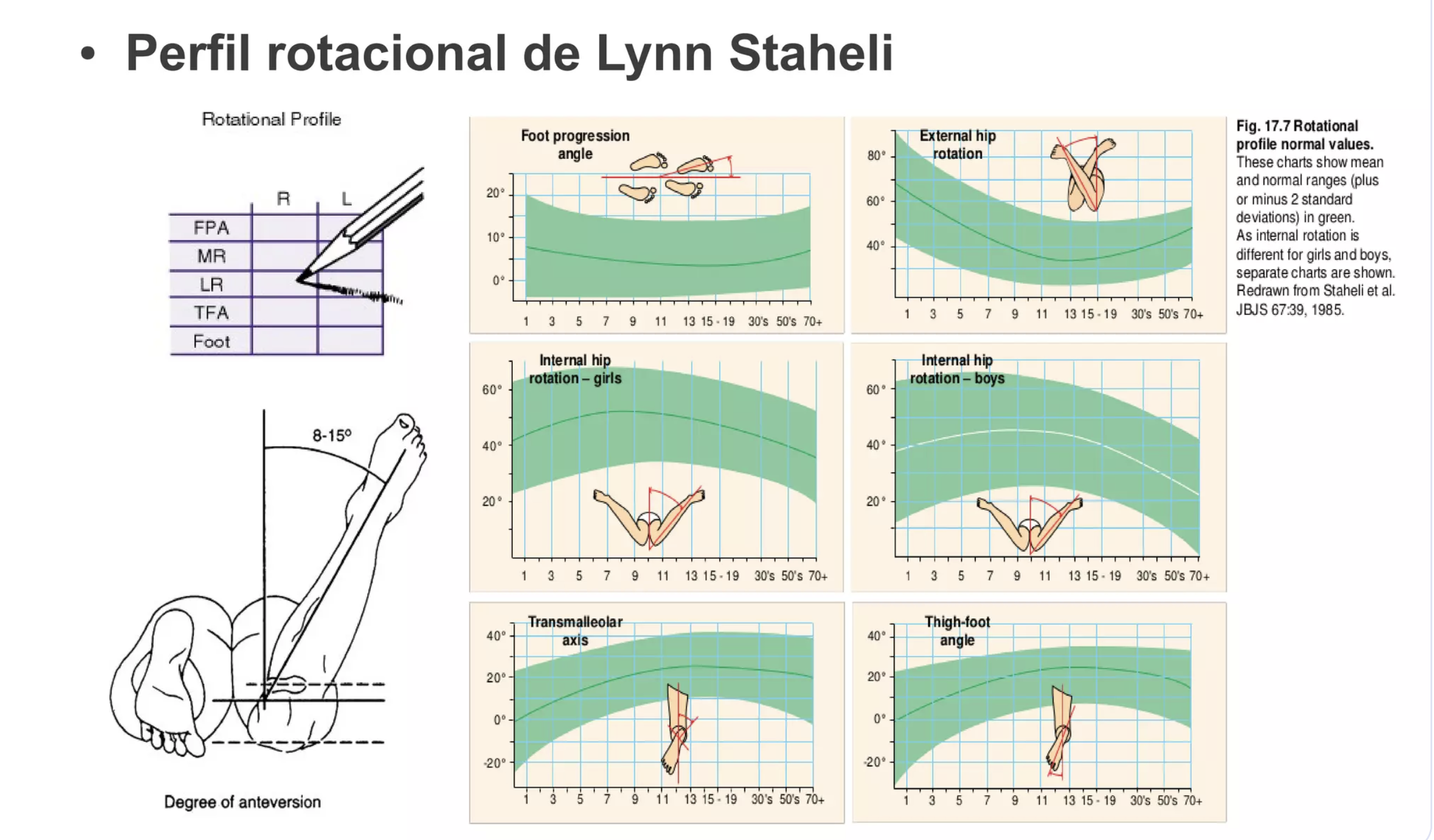 Imagen de anteversión femoral dentro del desarrollo normal de los miembros inferiores.