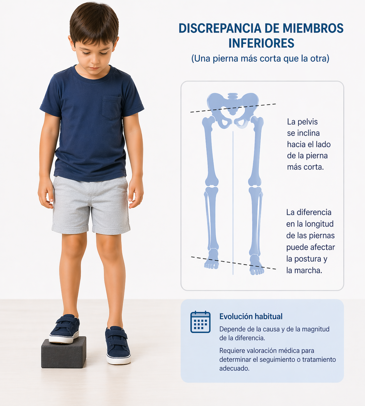 Imagen orientativa de diferencia de longitud en el miembro inferior.