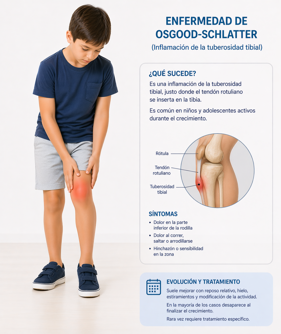 Ilustración adicional de Osgood-Schlatter en niños y adolescentes.